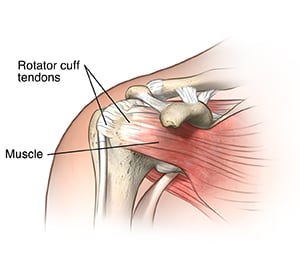 Front view of shoulder joint showing ligaments, muscles. and tendons.